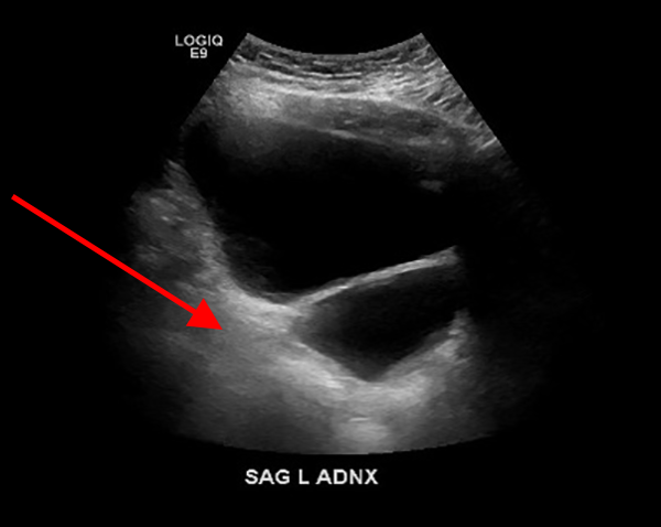 Quiz image - common ultraound artifacts